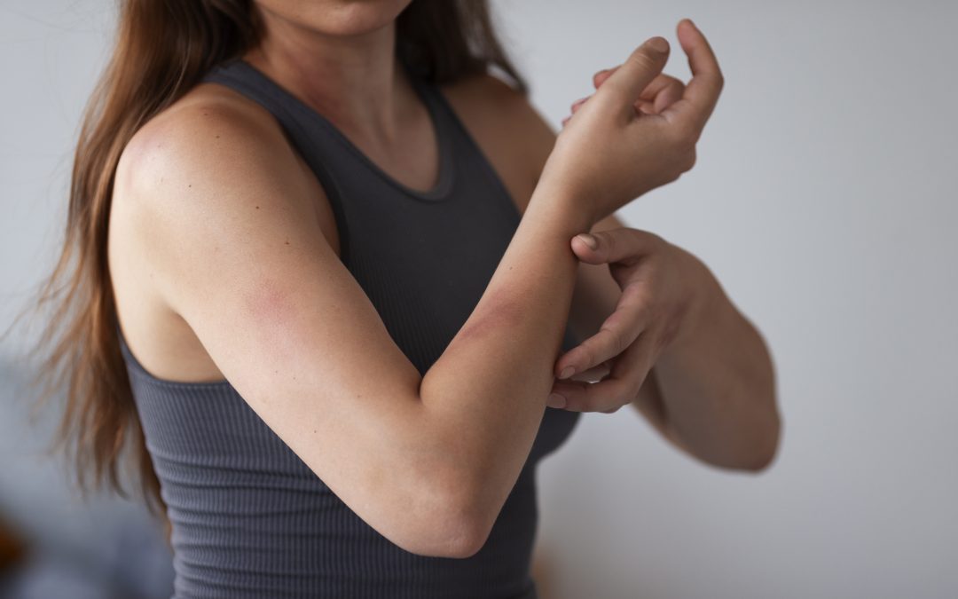 Com gaudir de l’estiu sense molèsties per les picades de mosquit