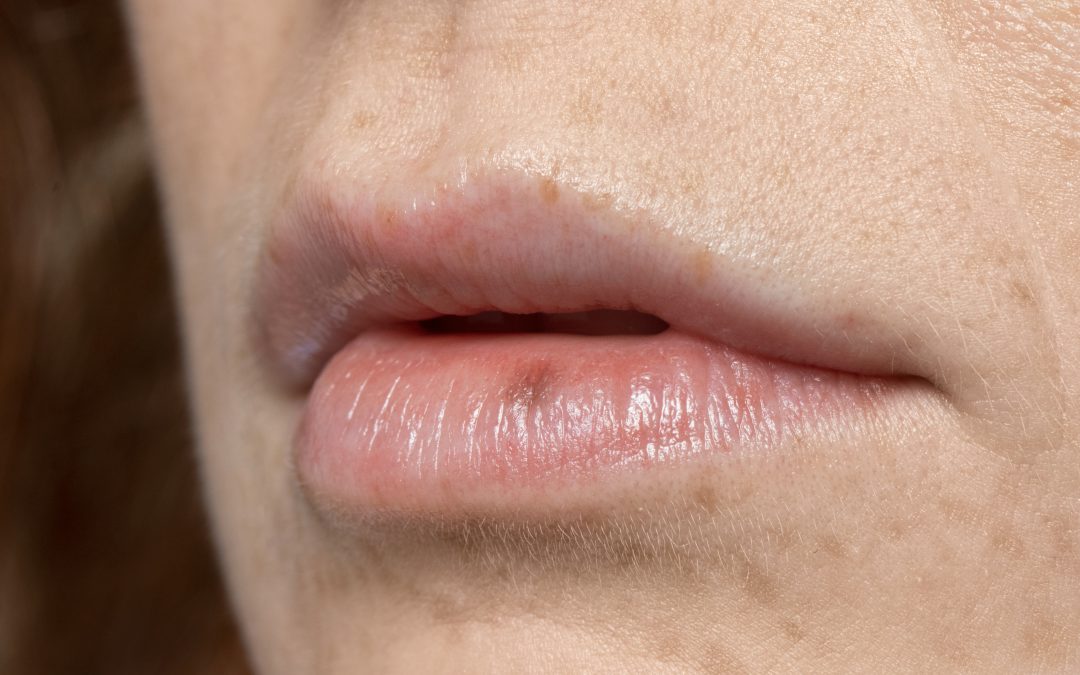 Llavis tallats i mans seques: com cuidar-los amb l’arribada del fred